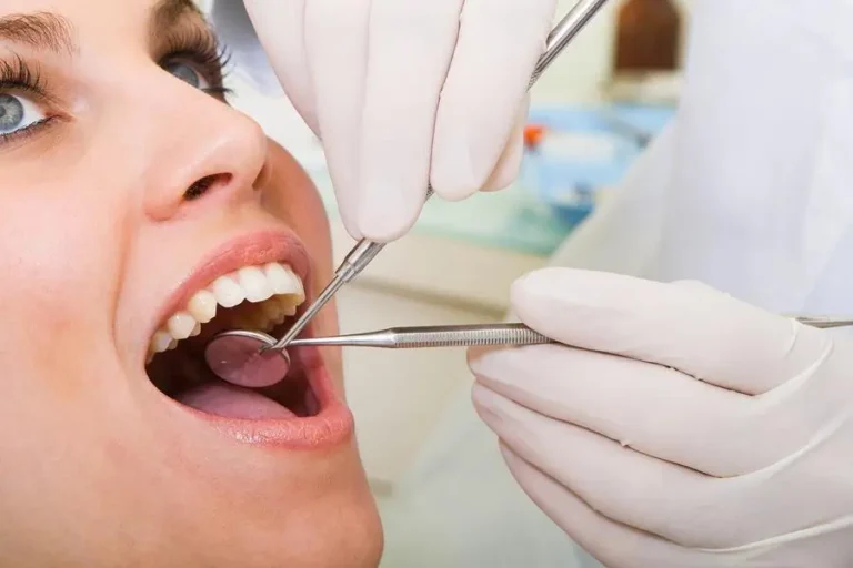 How to Find an Affordable Dentist Without Insurance